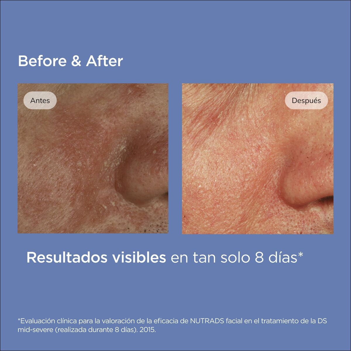 943811885 - NUTRADEICA GEL CREMA VISO 50 ML - 4703655_15.jpg