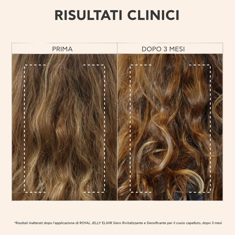 image - 950213052 - APIVITA ROYAL JELLY ELIXIR SCALP SIERO 50 ML - 4812923_10.jpg