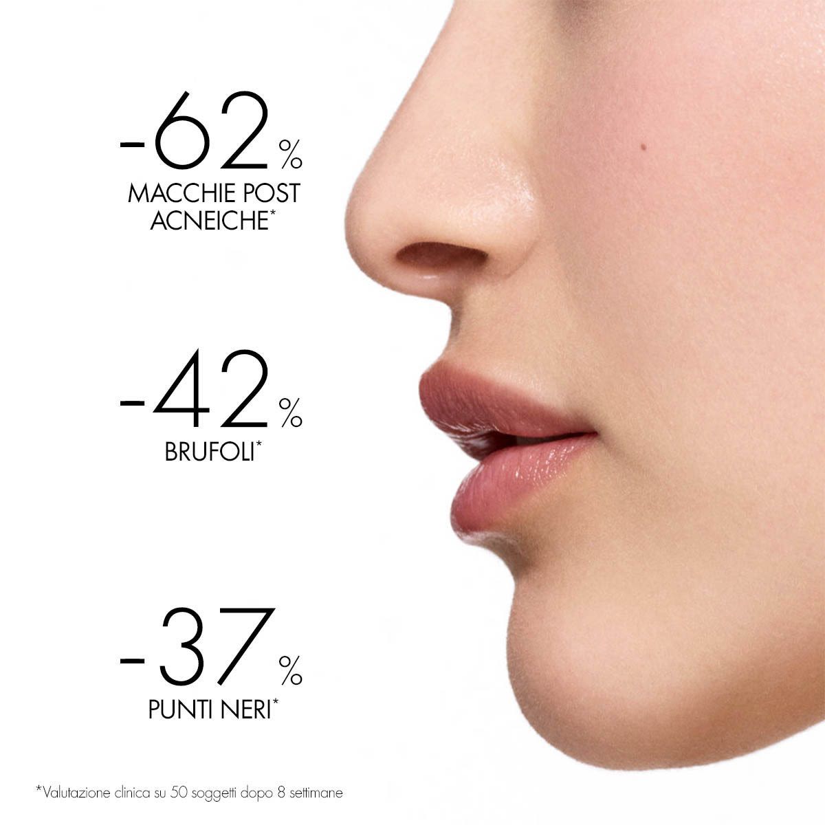 976390563 - Vichy Normaderm Phytosolution Trattamento anti imperfezioni 50ml - 7895732_4.jpg