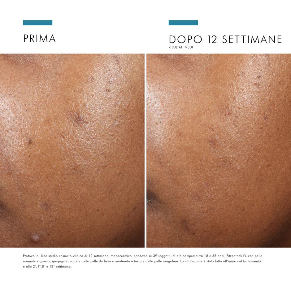 image - 983720588 - SKINCEUTICALS CORRECT PHYTO A BRIGHTENING TREATMENT 30 ML - 4709767_12.jpg