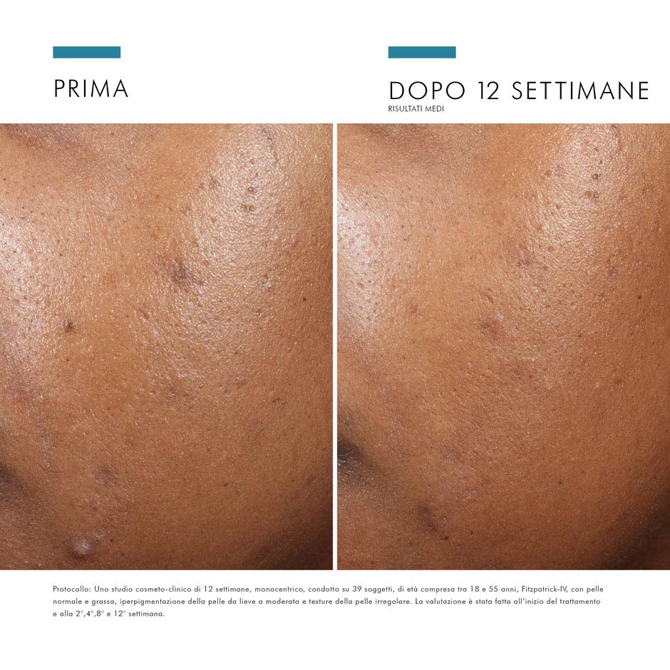 image - 983720588 - SKINCEUTICALS CORRECT PHYTO A BRIGHTENING TREATMENT 30 ML - 4709767_12.jpg