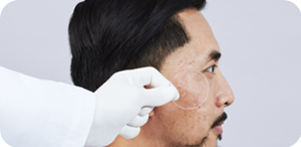 dermocosmesi-pelle-non-uniforme