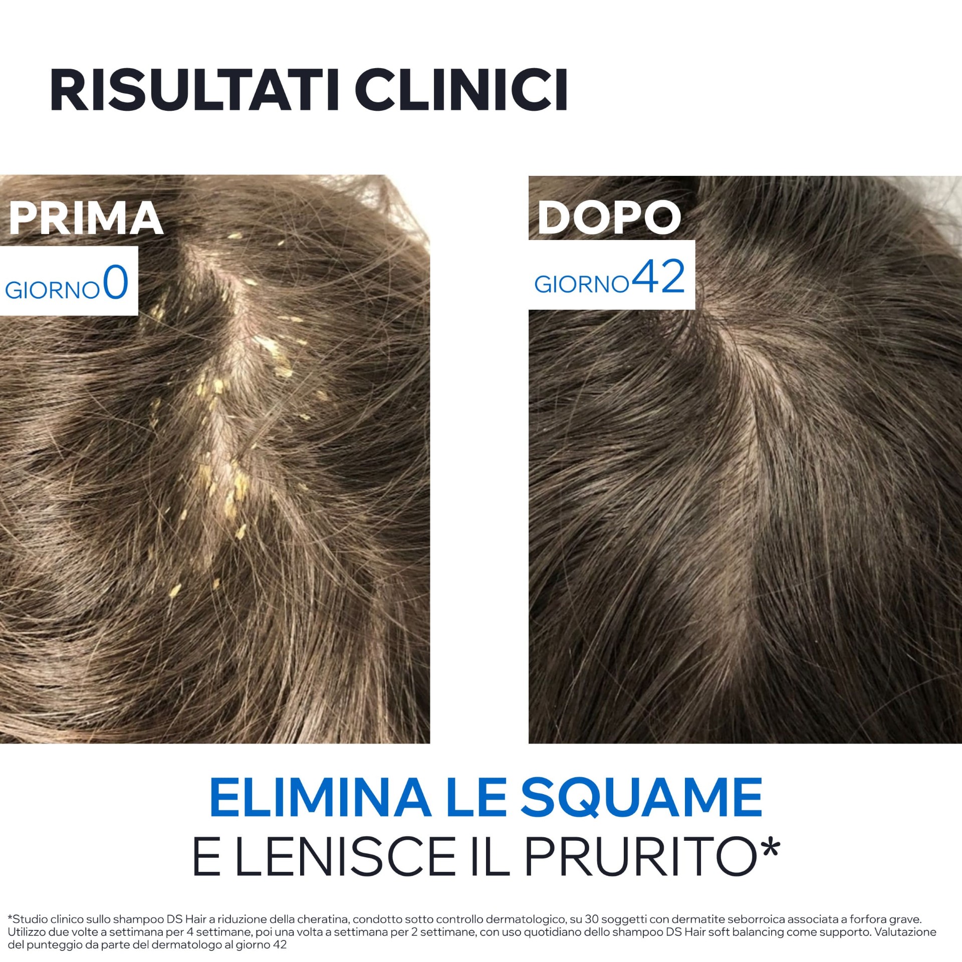 image - 984837599 - URIAGE DS HAIR SHAMPOO CHERATORIDUTTORE 150 ML - 4741411_10.jpg