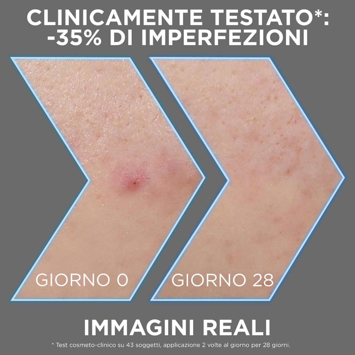 986035463 - Garnier PureActive Siero AHA+BHA anti-imperfezioni 30ml - 4742906_4.jpg