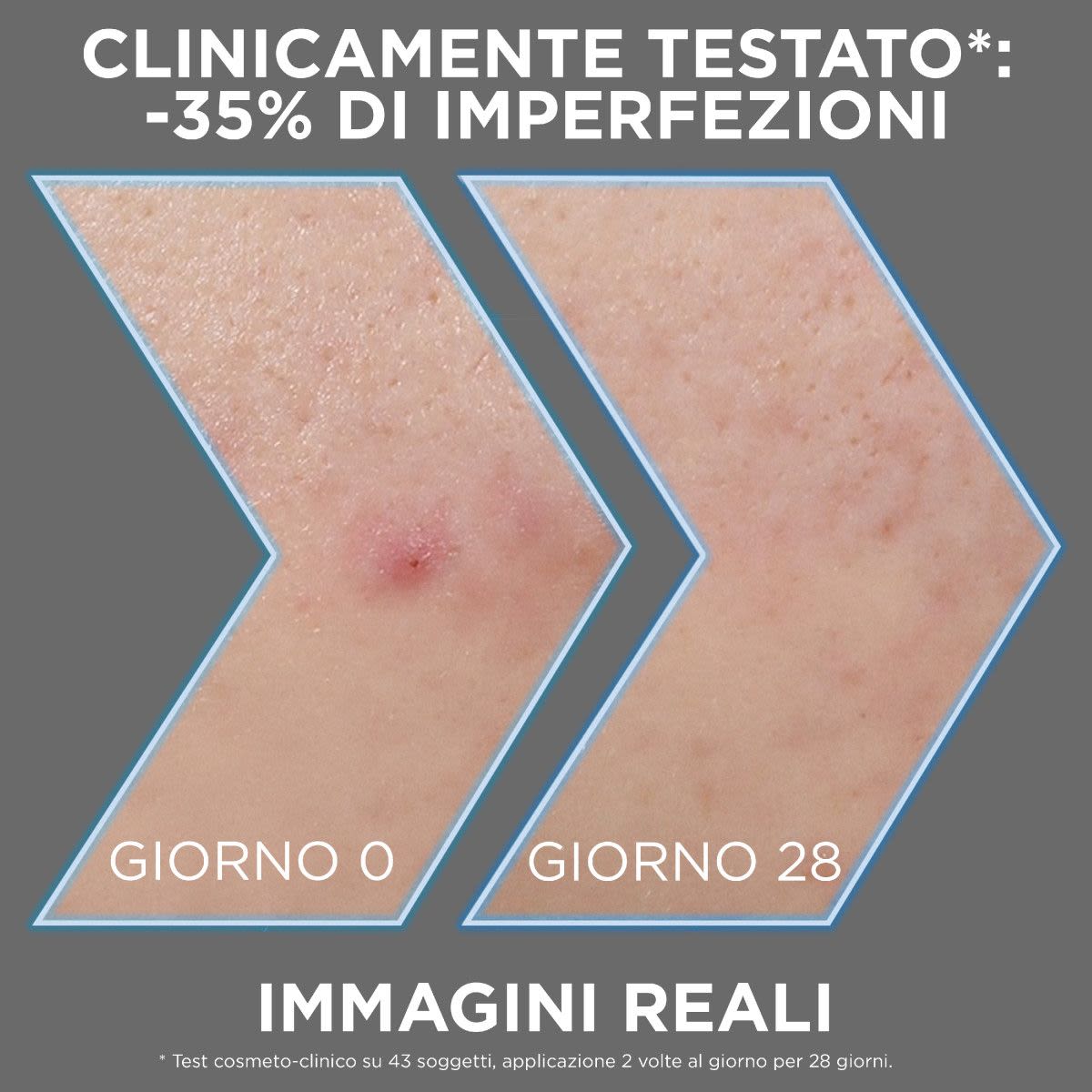 986035463 - Garnier PureActive Siero AHA+BHA anti-imperfezioni 30ml - 4742906_4.jpg