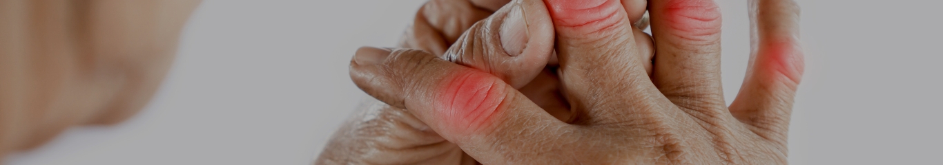 image - Articolazioni e inverno: come proteggere il benessere articolare nella stagione fredda