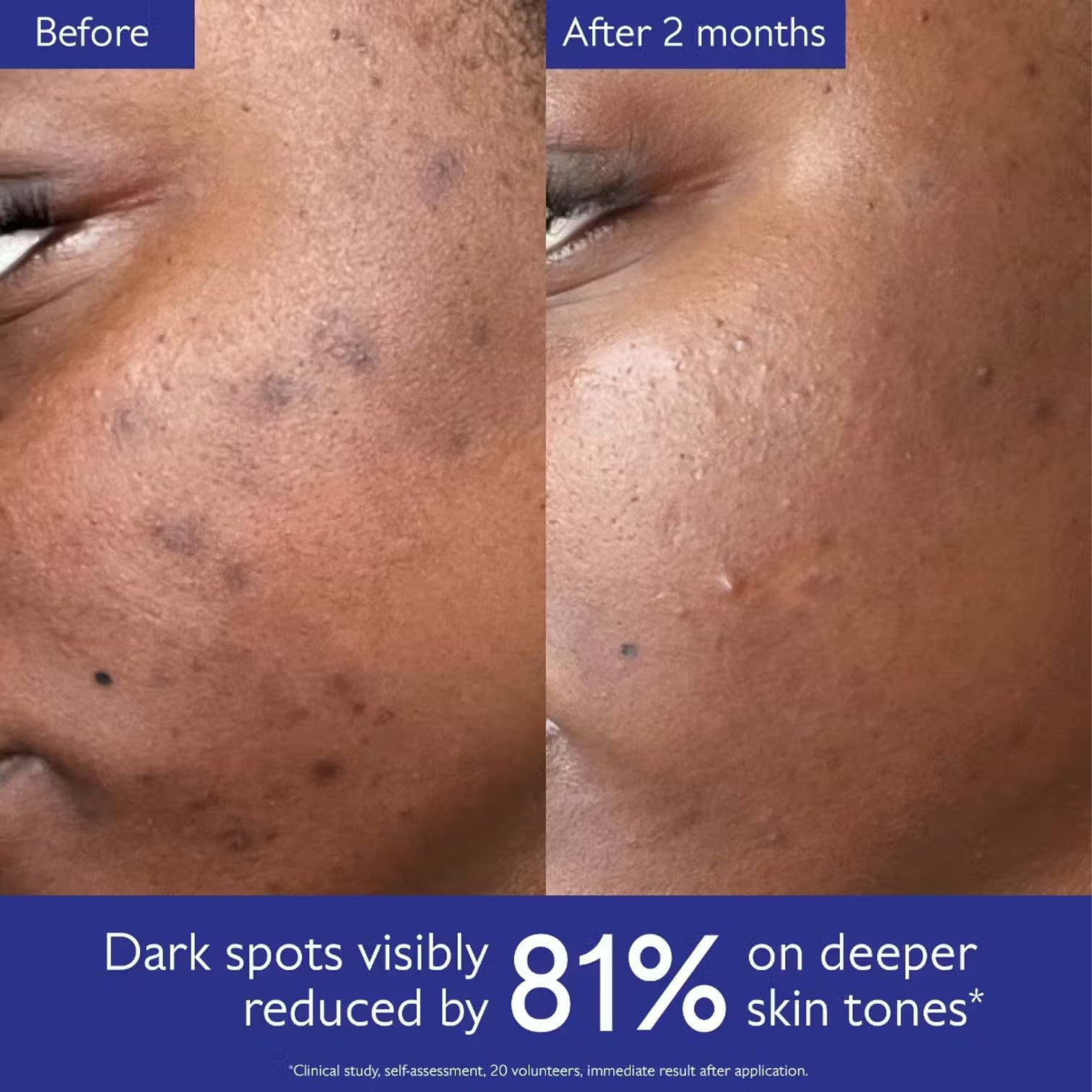 image - 952086623 - VINOPERFECT SPRING SET 2026 BRIGHTENING DARK SPOT SERUM 30 ML + DARK SPOT NIACINAMIDE MOISTURIZER 15 ML + BRIGHTENING GLYCOLIC NIGHT CREAM 15 ML - 4870732_4.jpg