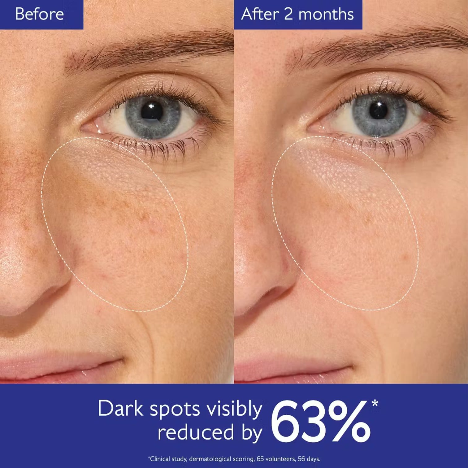 image - 952086623 - VINOPERFECT SPRING SET 2026 BRIGHTENING DARK SPOT SERUM 30 ML + DARK SPOT NIACINAMIDE MOISTURIZER 15 ML + BRIGHTENING GLYCOLIC NIGHT CREAM 15 ML - 4870732_3.jpg