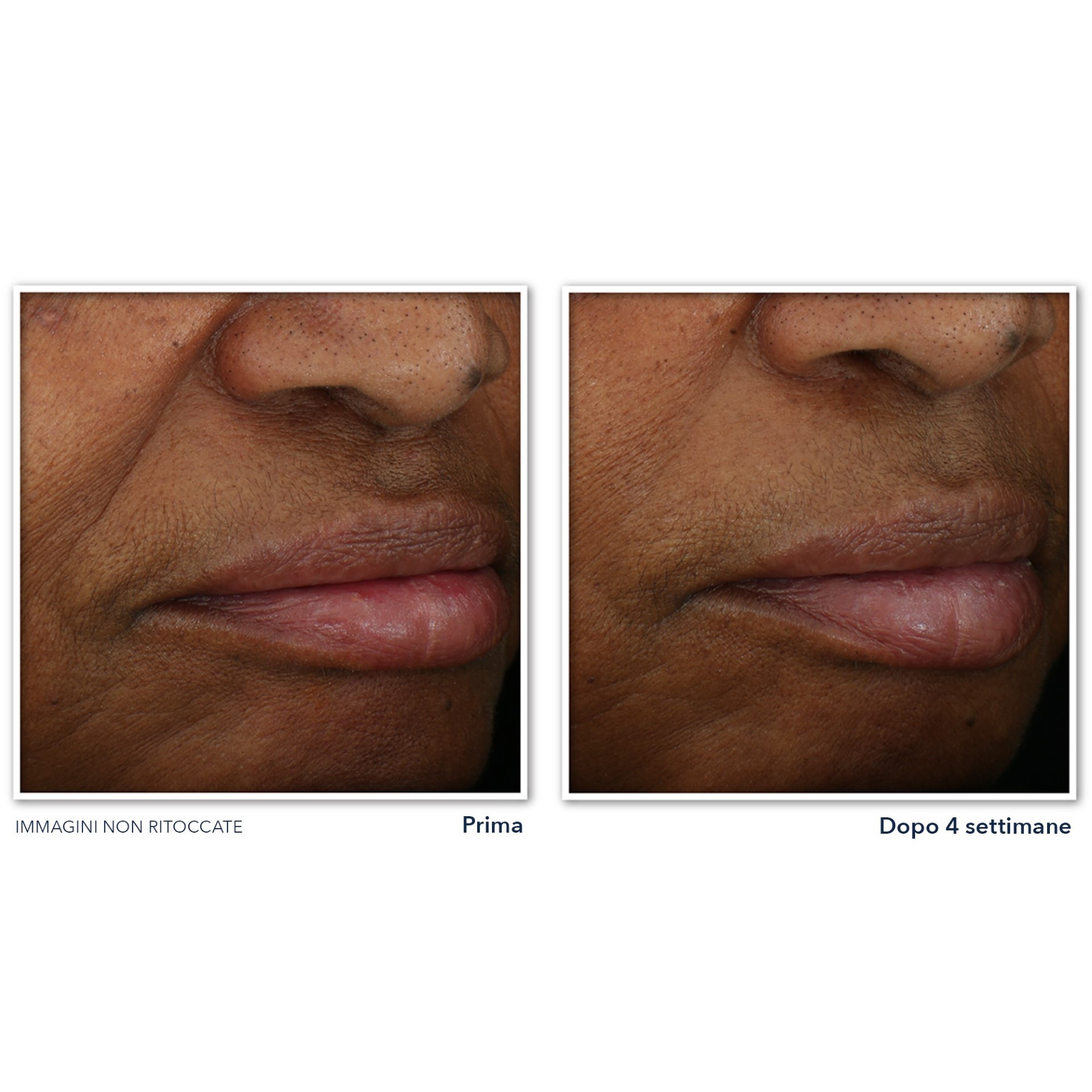 image - 980923179 - ROC MULTI CORREXION REVIVE + GLOW CREMA VISO GEL 50 ML - 4737051_7.jpg