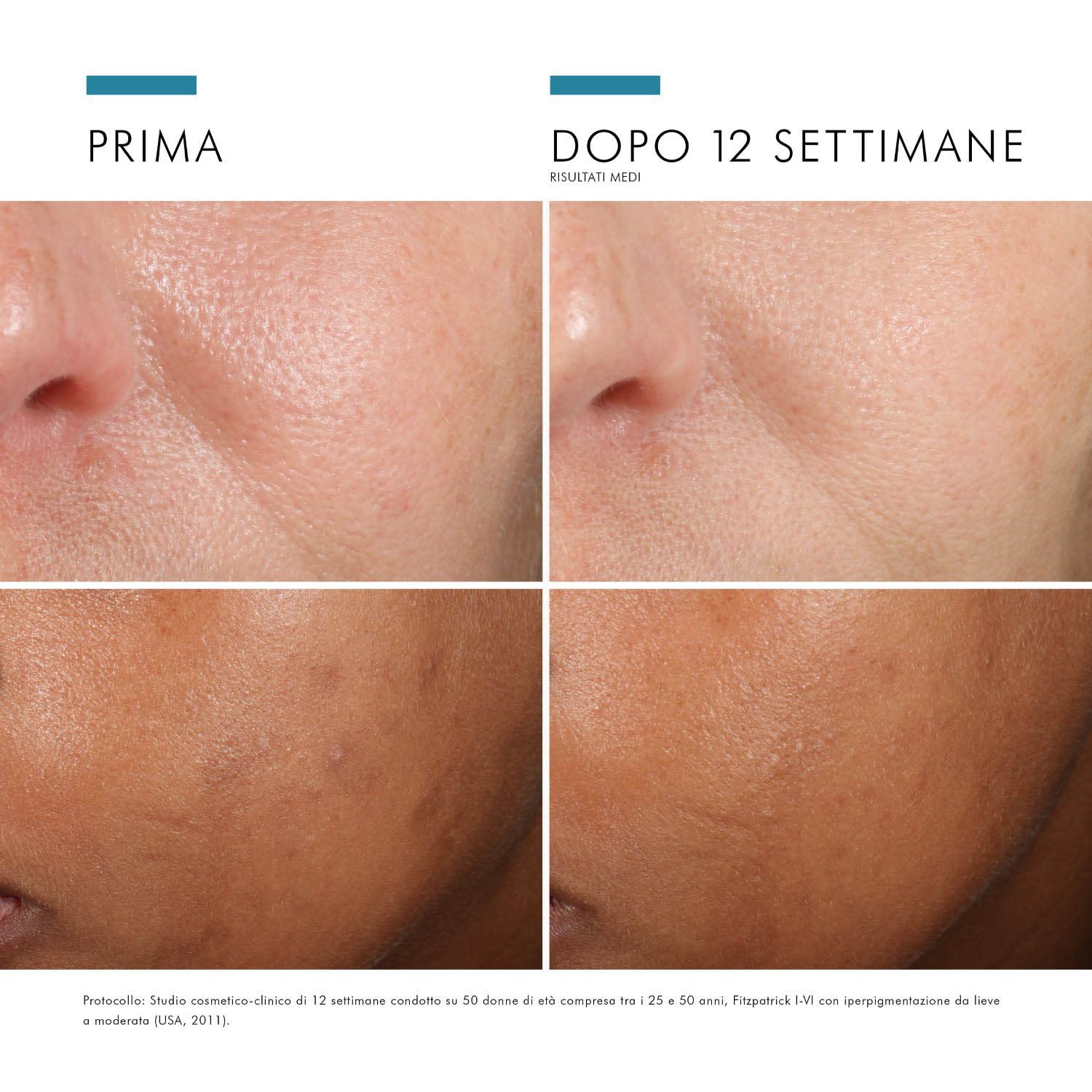 image - 913231611 - SkinCeuticals Phloretin CF Siero viso antiossidante con Vitamina C 30ml - 7870012_5.jpg