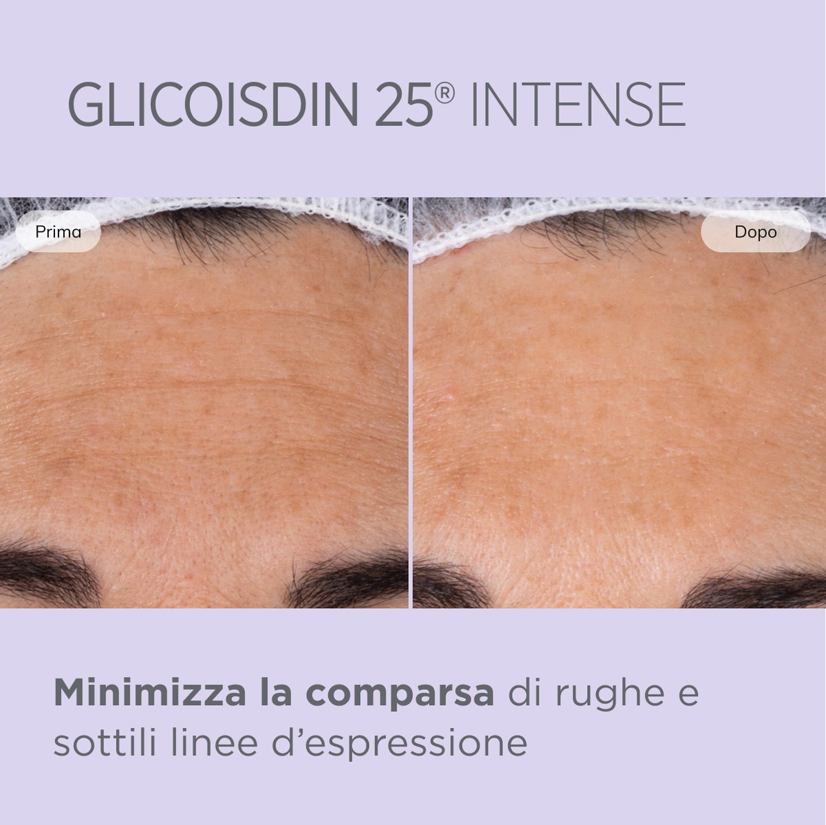 image - 943314524 - GLICOISDIN 25 INTENSE GEL 50ML - 4744101_9.jpg