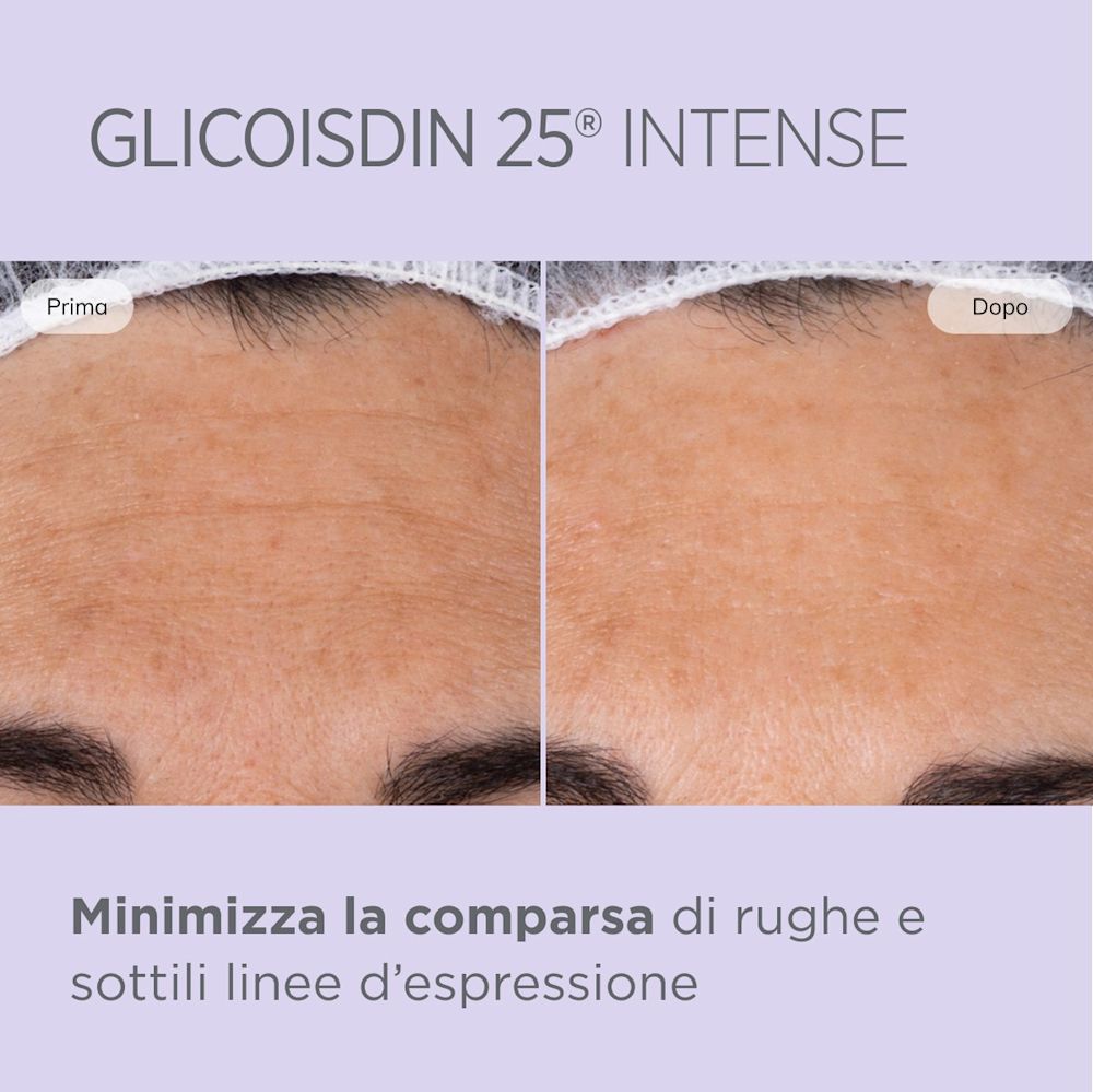 943314524 - GLICOISDIN 25 INTENSE GEL 50ML - 4744101_9.jpg