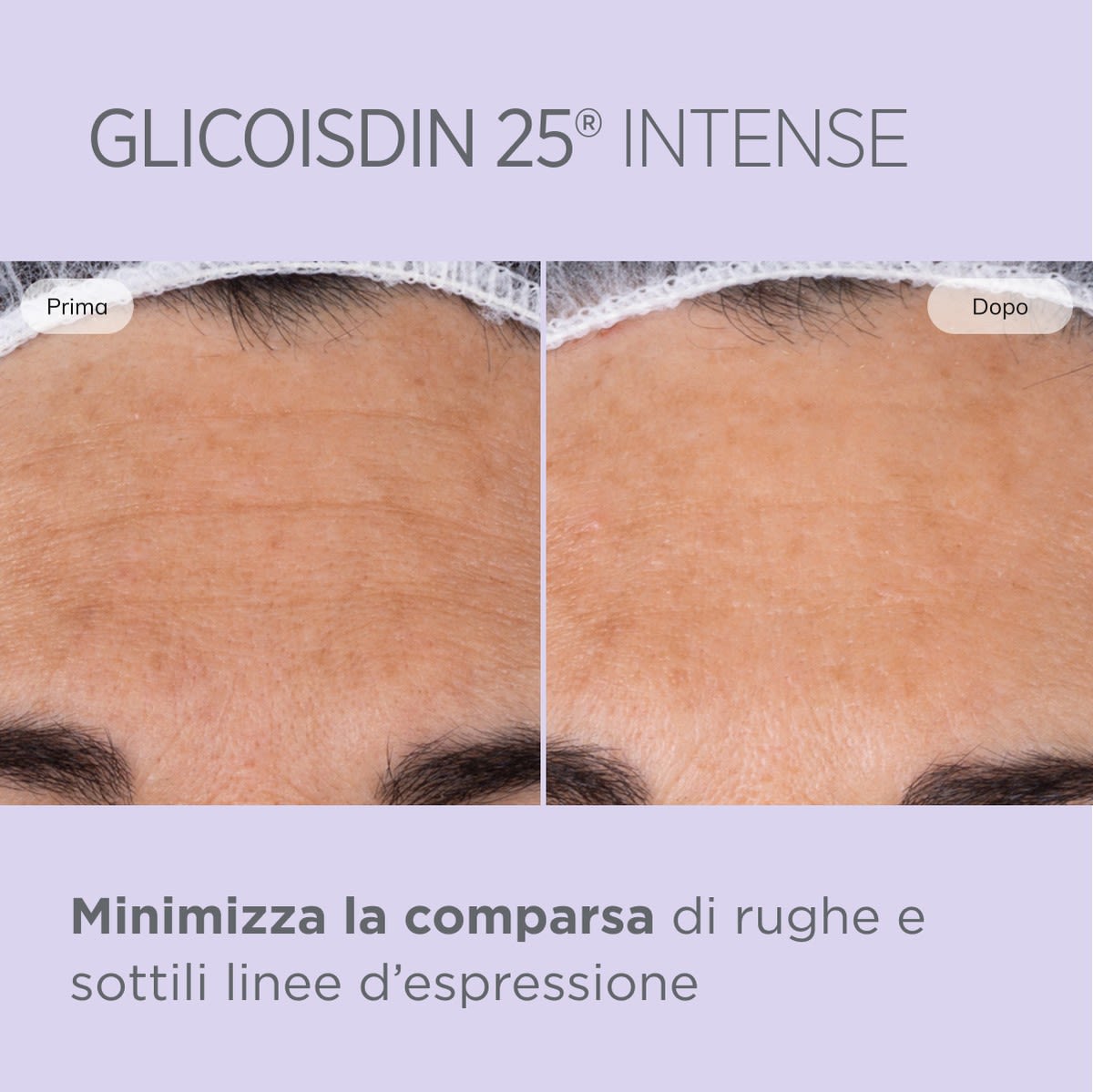 image - 943314524 - GLICOISDIN 25 INTENSE GEL 50ML - 4744101_9.jpg