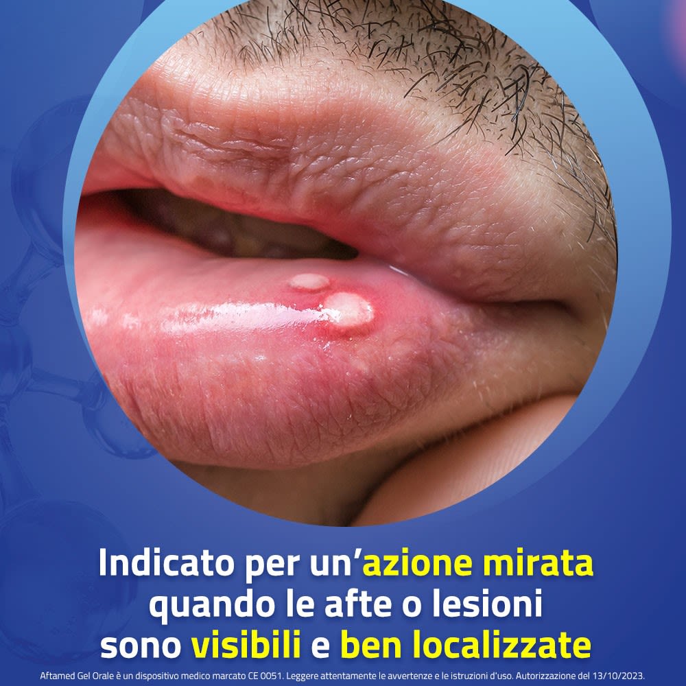 943303507 - GEL AFTAMED 10 ML - 4787671_7.jpeg