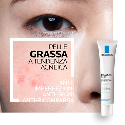 Pelle Grassa a tendenza Acneica