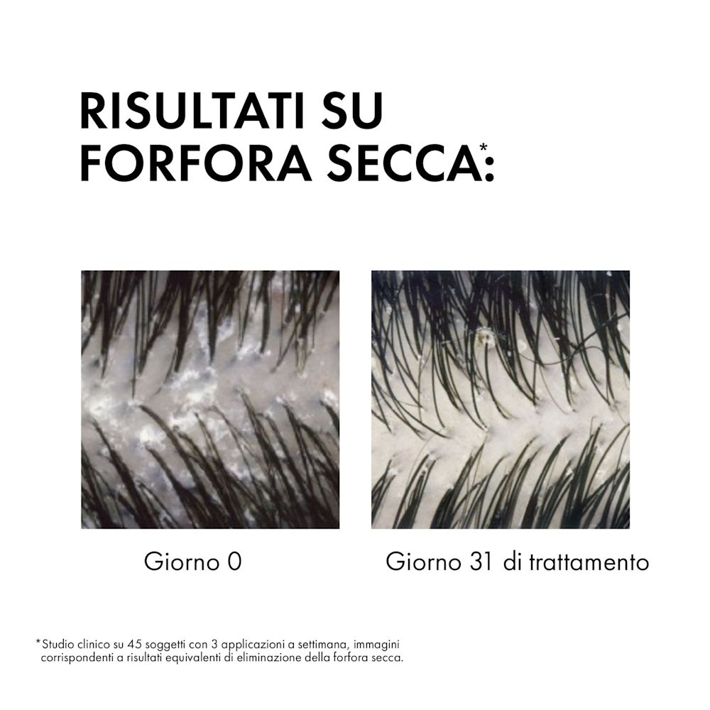 image - 972067957 - DERCOS SHAMPO ANTIFORFORA SECCHI 390 ML - 4812588_4.jpg