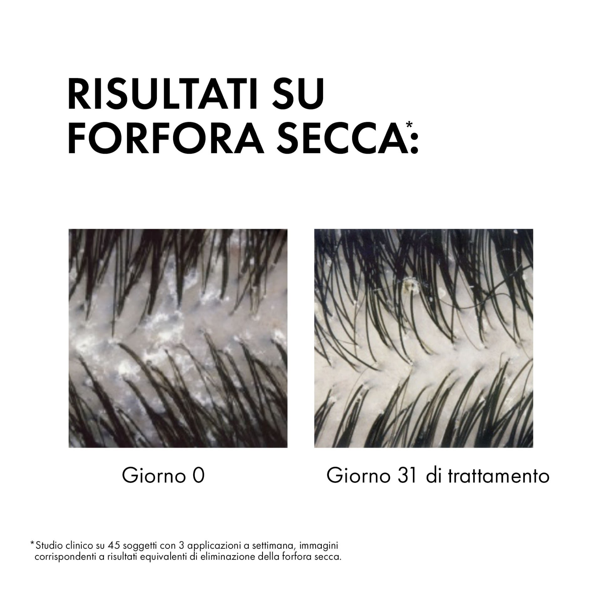 image - 972067957 - DERCOS SHAMPO ANTIFORFORA SECCHI 390 ML - 4812588_4.jpg