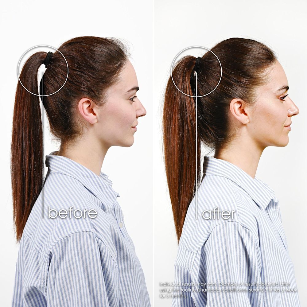 950026284 - KLORANE TRATTAMENTO FORTIFICANTE INTENSO CHININA 100 ML - 4819682_4.jpg