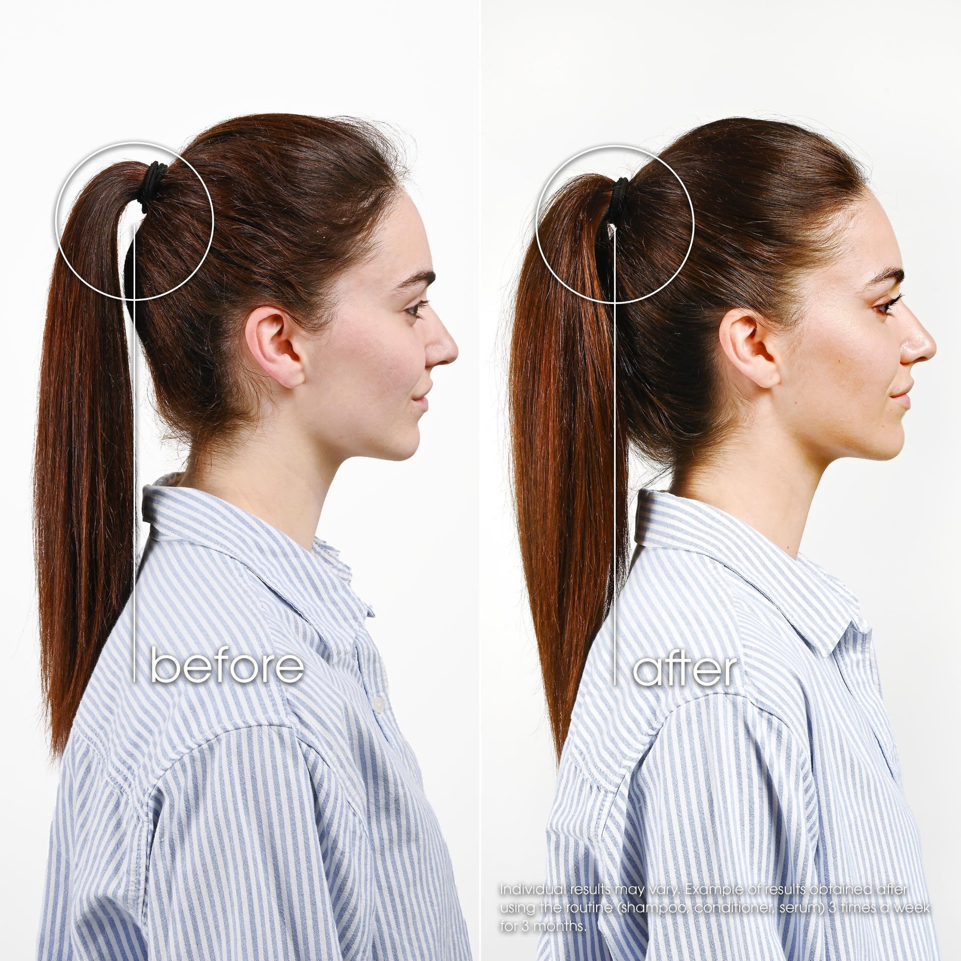 950026284 - KLORANE TRATTAMENTO FORTIFICANTE INTENSO CHININA 100 ML - 4819682_4.jpg