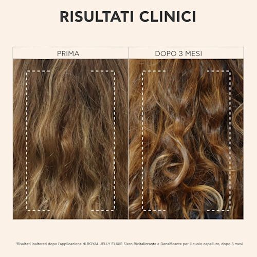 image - 950213052 - APIVITA ROYAL JELLY ELIXIR SCALP SIERO 50 ML - 4812923_2.jpg
