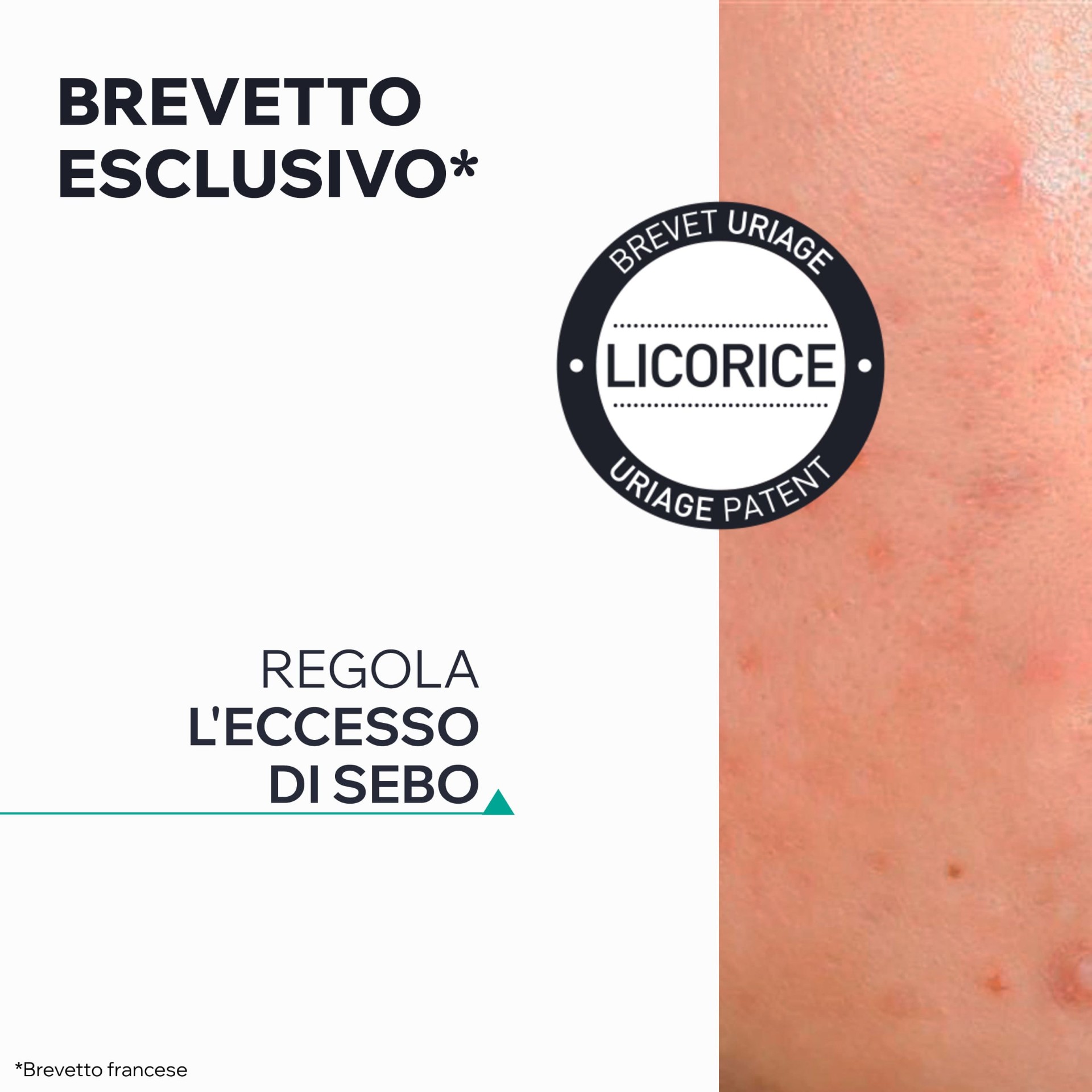 image - 988988578 - HYSEAC GEL SOS PURIFICANTE 15 ML - 4789122_6.jpg