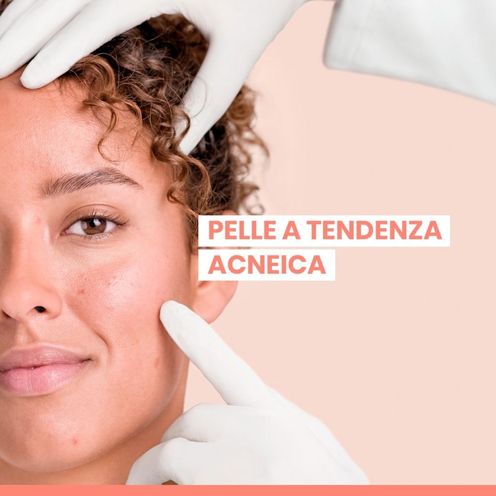 image - 951887114 - Siero intensivo anti-imperfezioni formulato per ridurre brufoli e punti neri e prevenire la loro ricomparsa. - 4875349_12.jpg