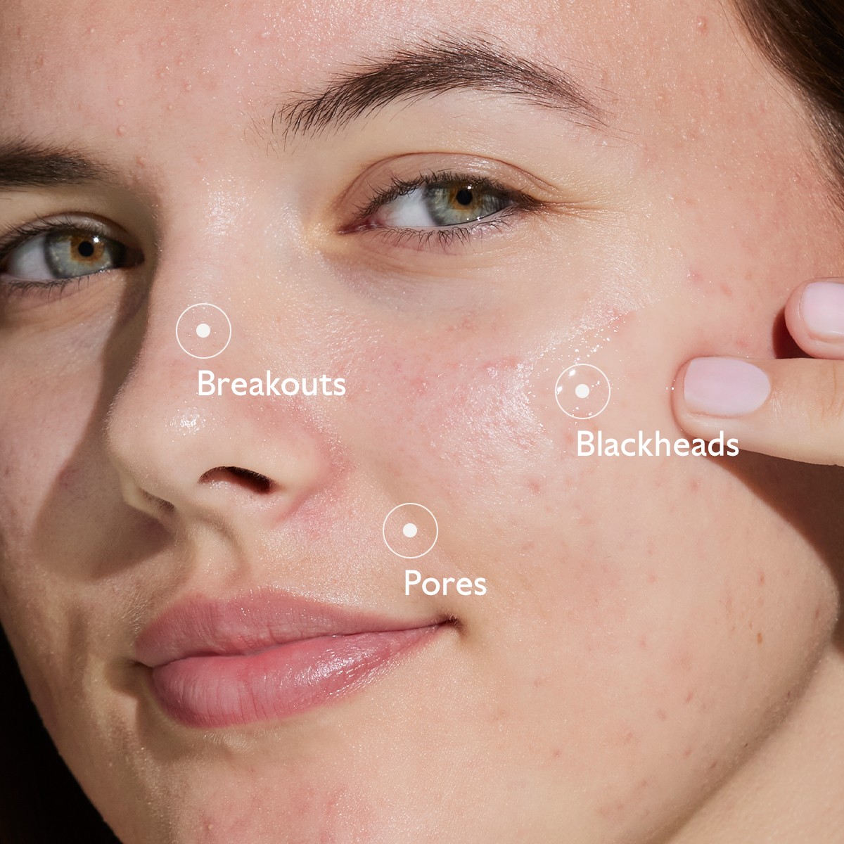 image - 950913640 - VINOPURE SIERO ANTI IMPERFEZIONI 30 ML - 4844547_6.jpg