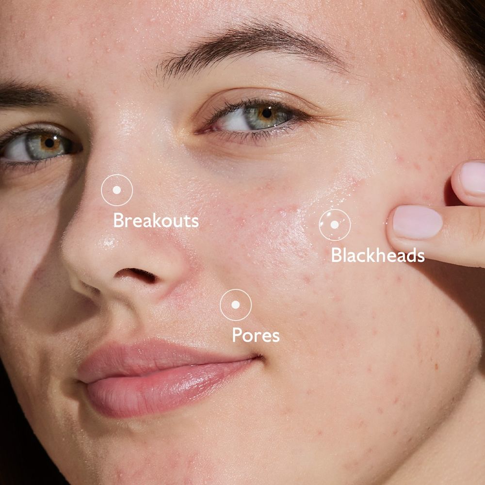 image - 950913640 - VINOPURE SIERO ANTI IMPERFEZIONI 30 ML - 4844547_6.jpg