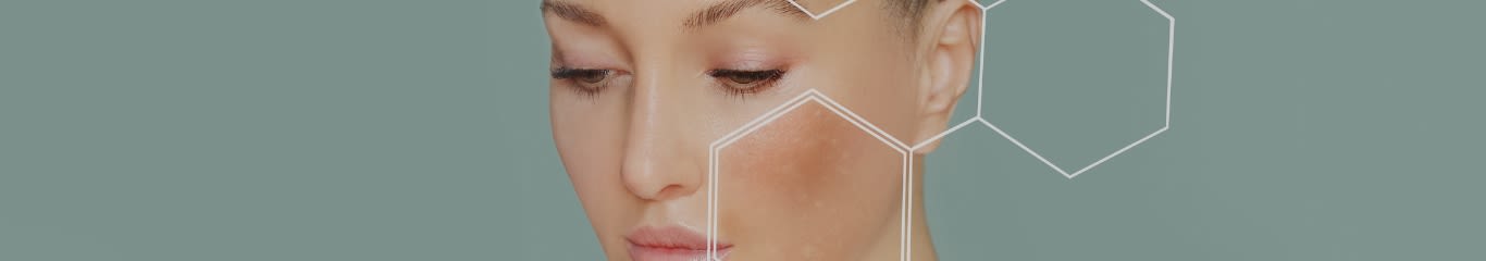 Skincare per pelle mista: come scegliere i prodotti giusti