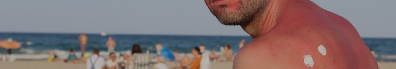 image - Doposole o crema Idratante? Caratteristiche e differenze