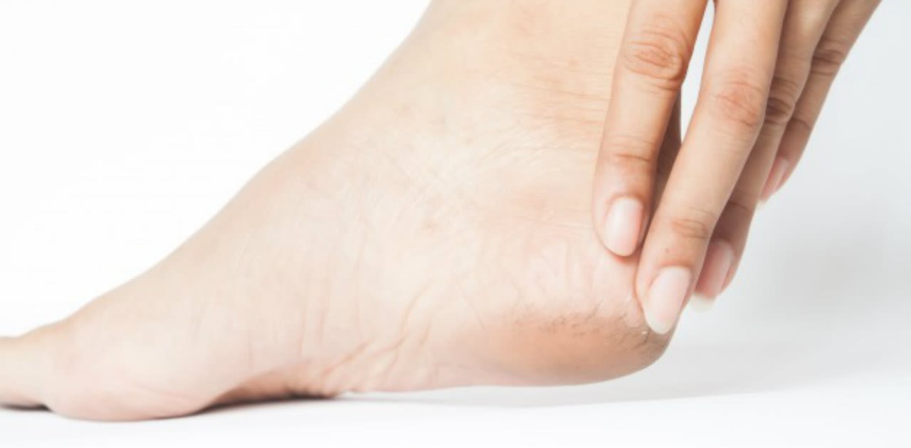 Magazine | Vesciche ai piedi fastidi cause e rimedi