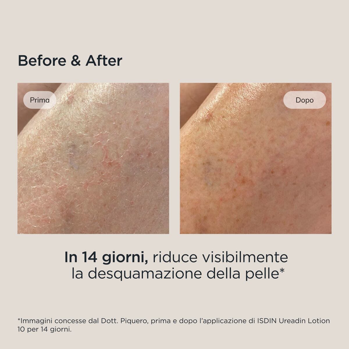 image - 942602956 - UREADIN LOTION 10 400 ML - 4703644_12.jpg