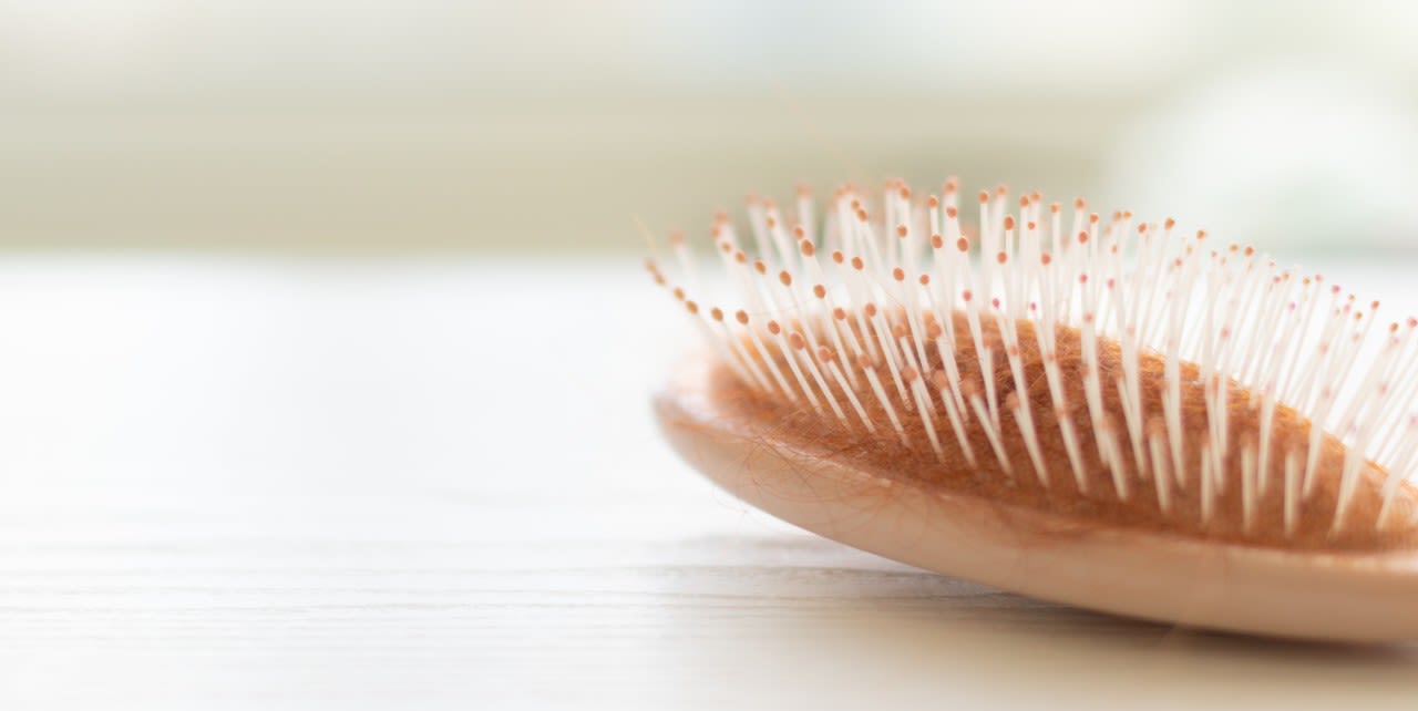 Magazine | Perdita di capelli in autunno cinque consigli utili
