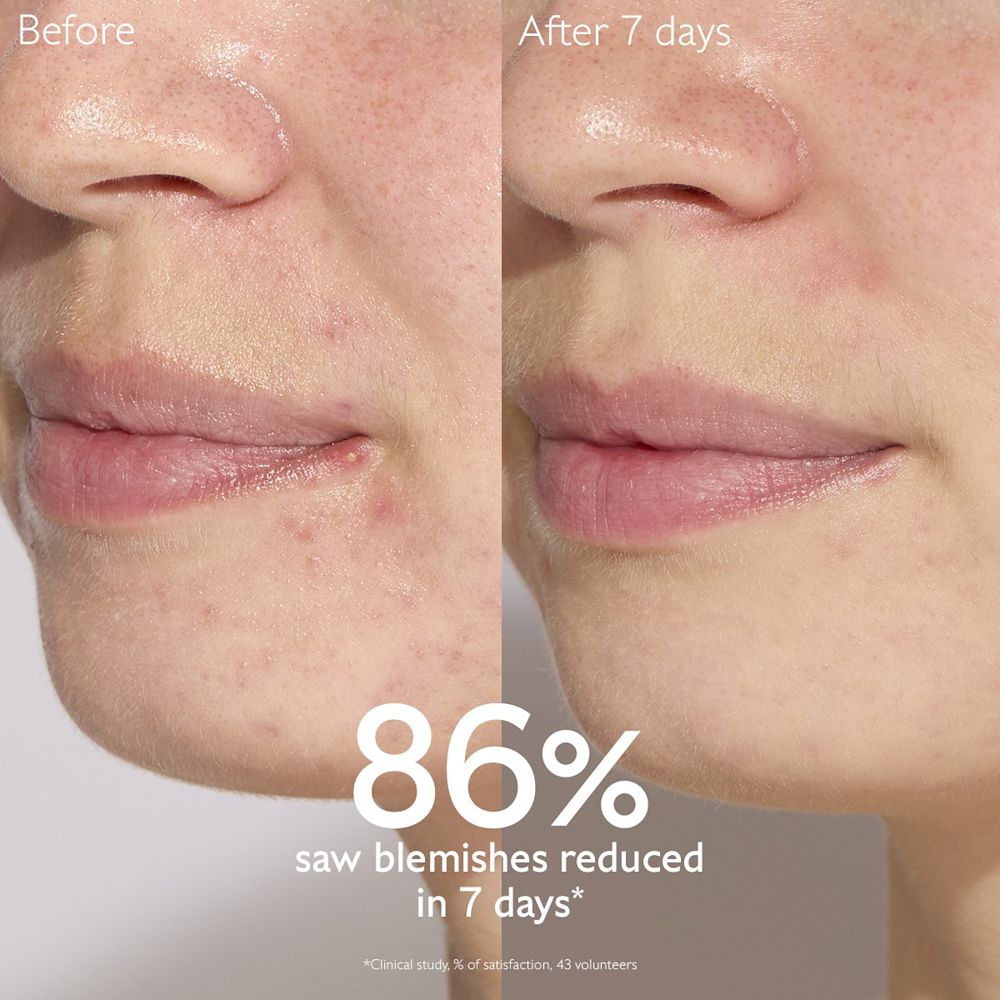 image - 950913640 - VINOPURE SIERO ANTI IMPERFEZIONI 30 ML - 4844547_7.jpg