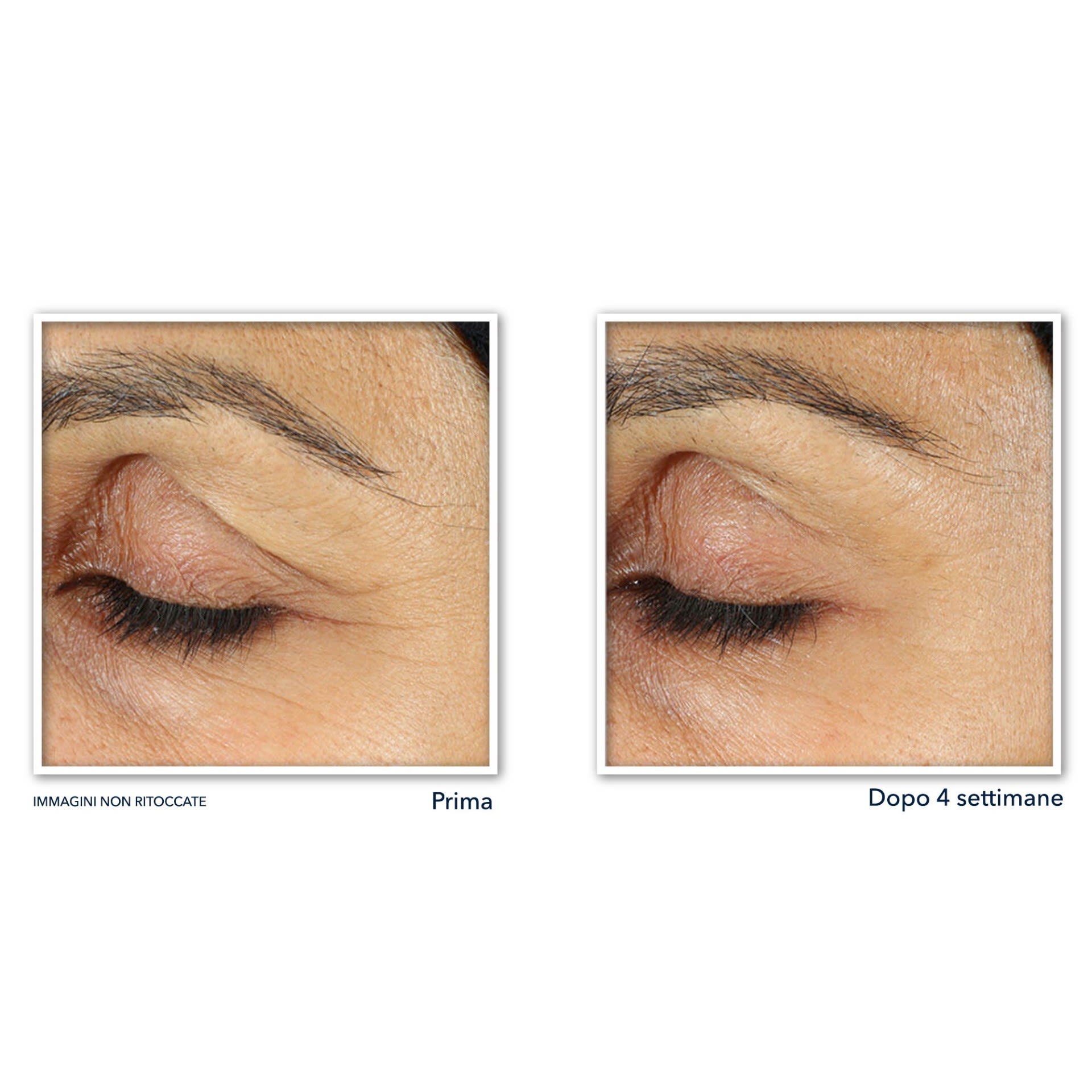 image - 980923142 - ROC RETINOL CORREXION LINE SMOOTHING CREMA OCCHI 15 ML - 4737048_7.jpg