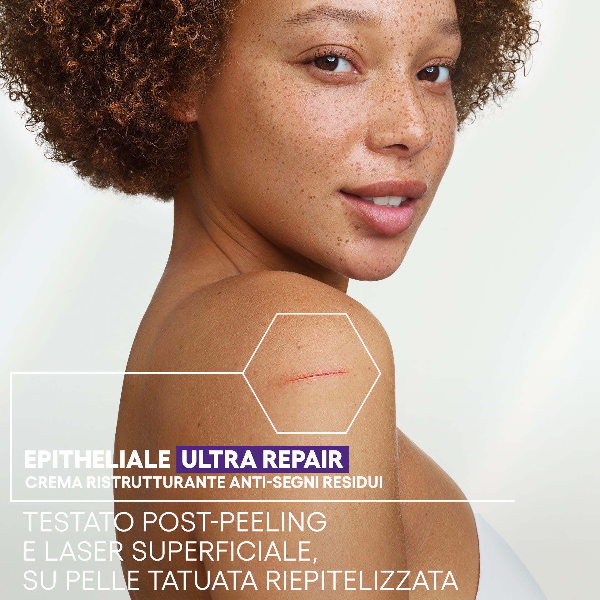 950406734 - EPITHELIALE ULTRA REPAIR CREMA RISTRUTTURANTE ANTI SEGNI RESIDUI 100 ML - 4836334_4.jpg