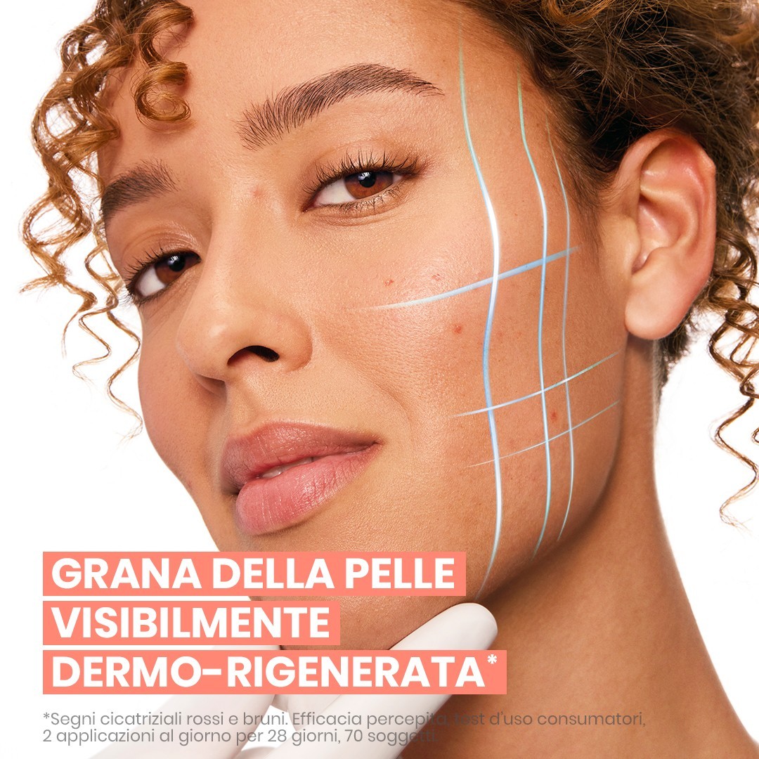 image - 951887114 - Siero intensivo anti-imperfezioni formulato per ridurre brufoli e punti neri e prevenire la loro ricomparsa. - 4875349_13.jpg