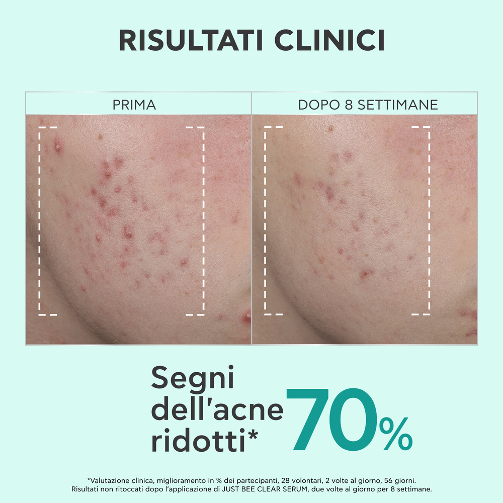 image - 951888460 - Siero perfezionatore Apivita Just Bee Clear, aiuta ad affinare la grana della pelle e ridurre macchie e imperfezioni. - 4864049_5.jpg