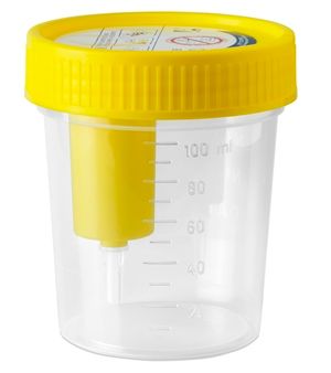 image - 938967926 - Contenitore sterile da 120 ml per la raccolta di urine, graduato fino a 100 ml, con tappo a vite e dispositivo integrato per prelievo con provetta sottovuoto. - 7888173_1.jpg