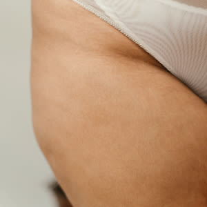 cellulite