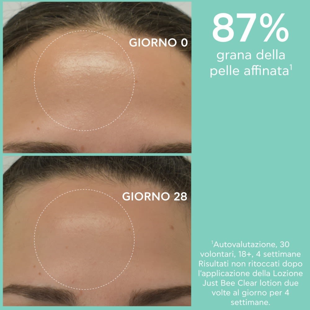 989055571 - APIVITA JUST BEE CLEAR LOTION 200 ML - 4784517_5.jpg