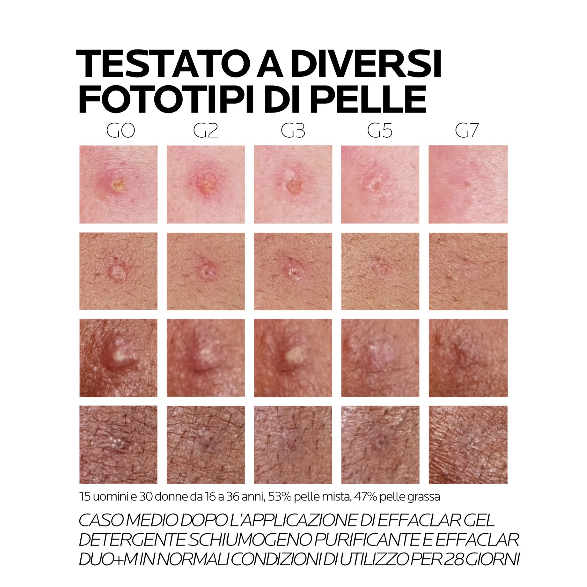 image - 987019130 - EFFACLAR DUO +M 40 ML - 4744334_12.jpg