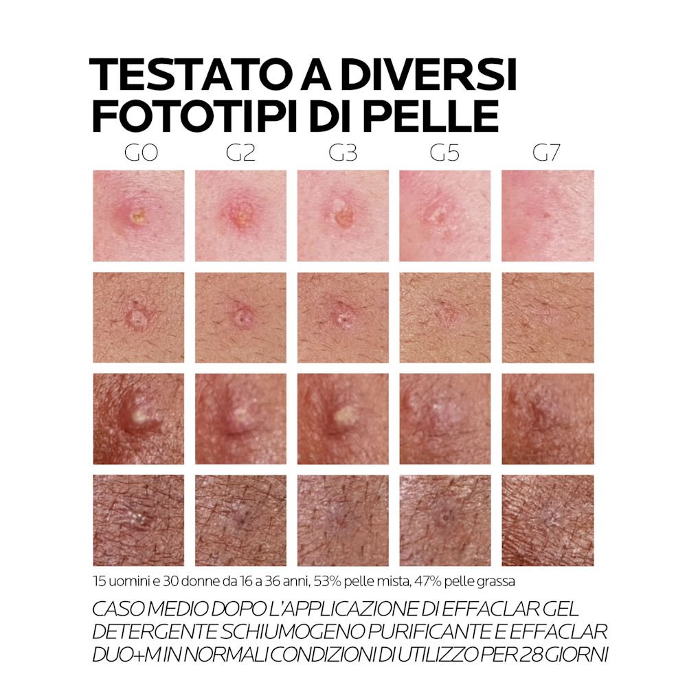 image - 987019130 - EFFACLAR DUO +M 40 ML - 4744334_12.jpg