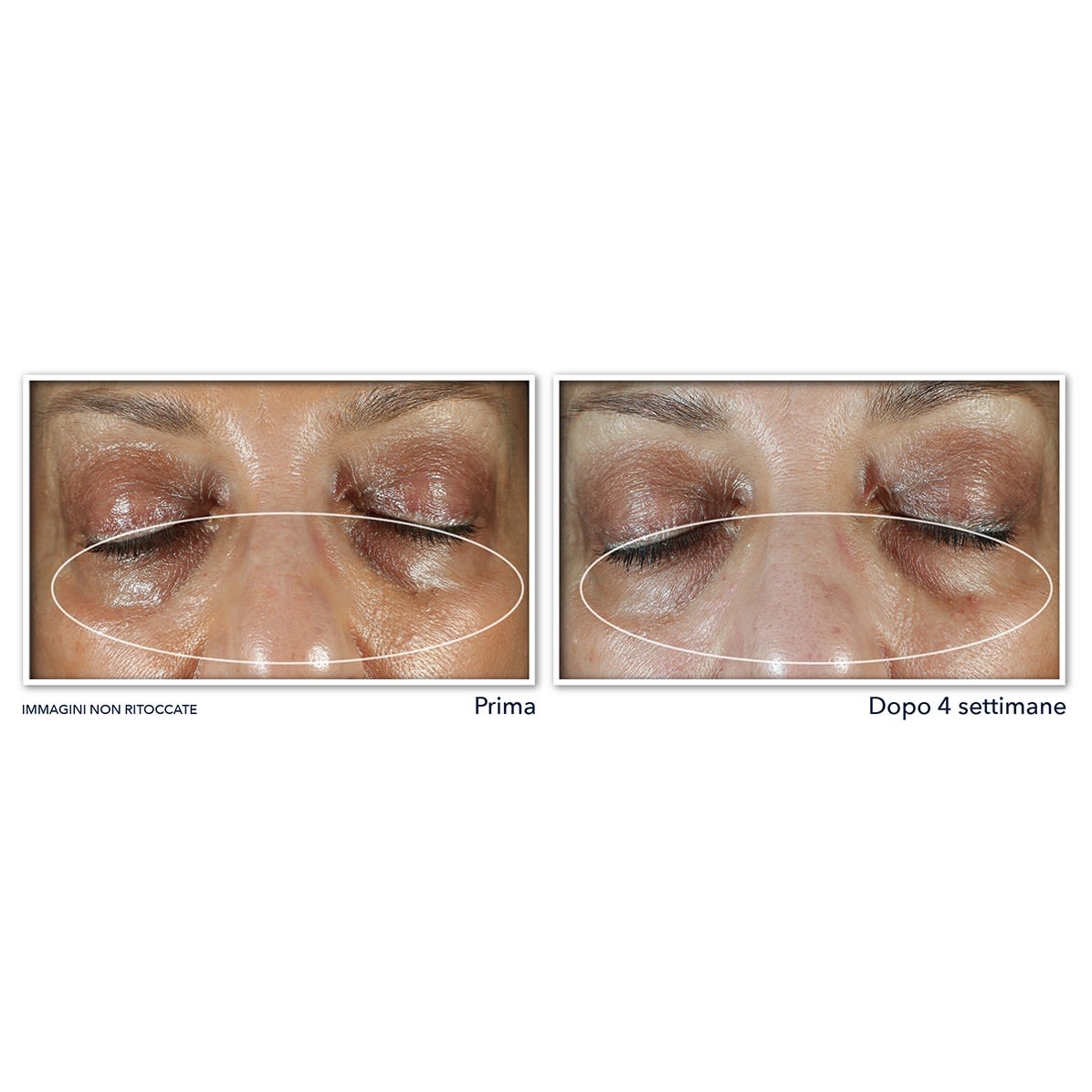 image - 987066952 - ROC MULTI CORREXION EVEN TONE + LIFT EYE CREAM 15 ML - 4745730_5.jpg