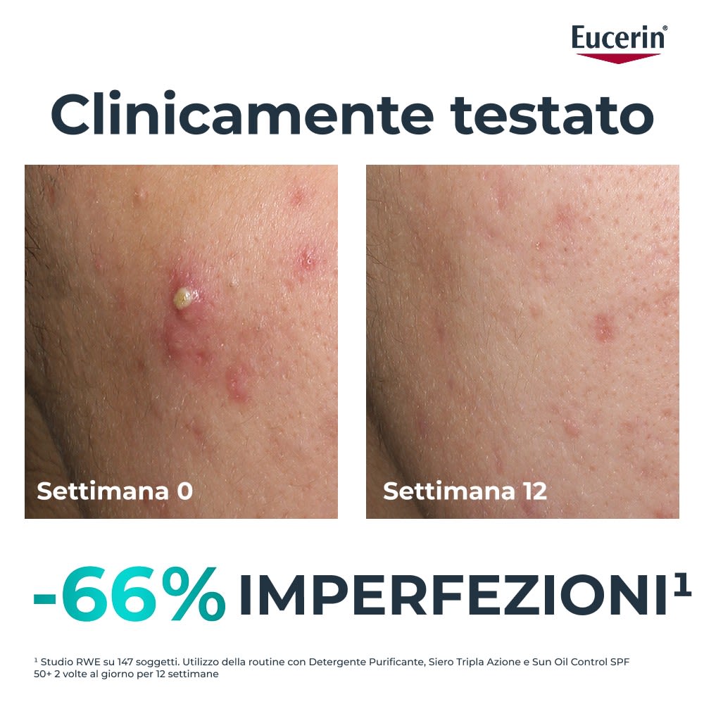 951091913 - EUCERIN DERMOPURE CLINICAL SIERO TRIPLA AZIONE 40 ML - 4840788_14.jpg