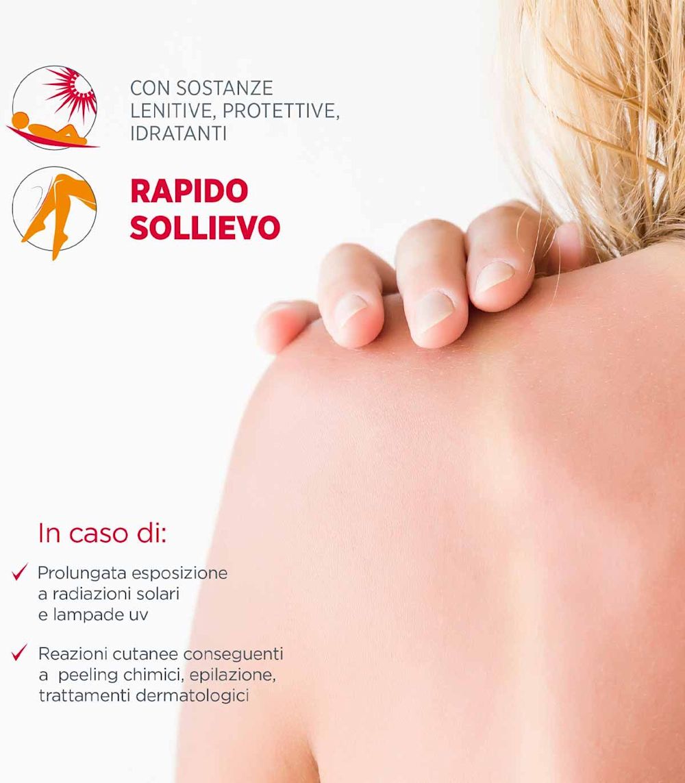 981498013 - Dermovitamina Fotoclin Spray Lenitivo Sole 100ml - 4737732_5.jpg