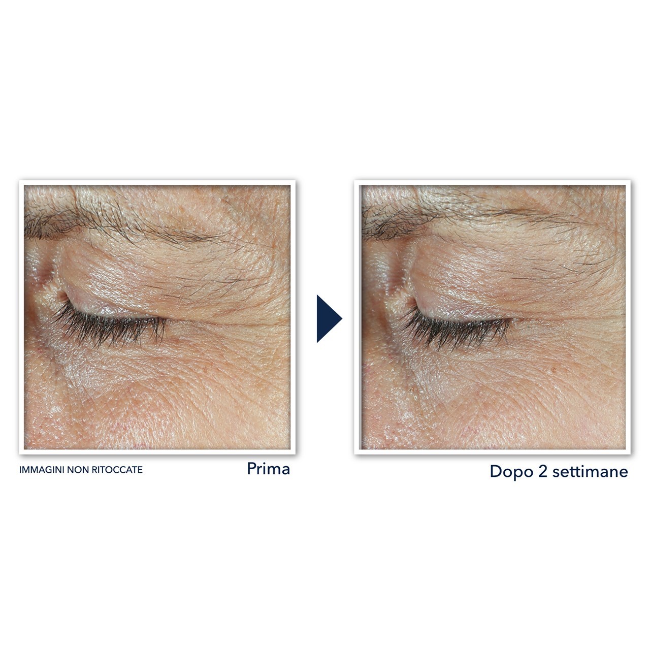 image - 987837604 - ROC DERM CORREXION DUAL EYE CREAM 20 ML - 4762754_6.JPG