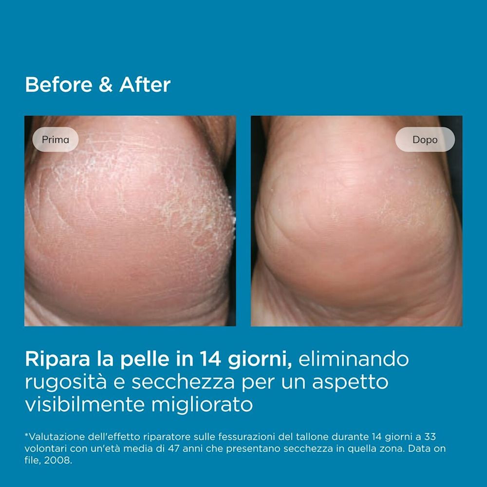 image - 939806473 - UREADIN PODOS GEL-OIL 75 ML - 7889667_16.jpg