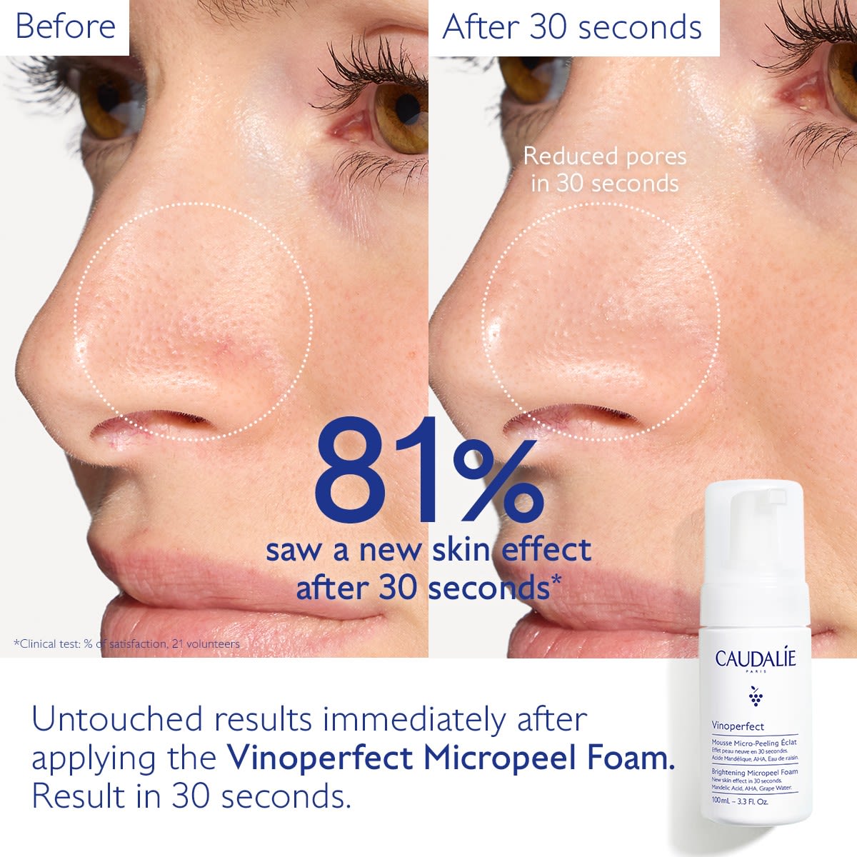 image - 987851058 - VINOPERFECT MOUSSE MICROPEELING 100 ML - 4768851_6.jpg