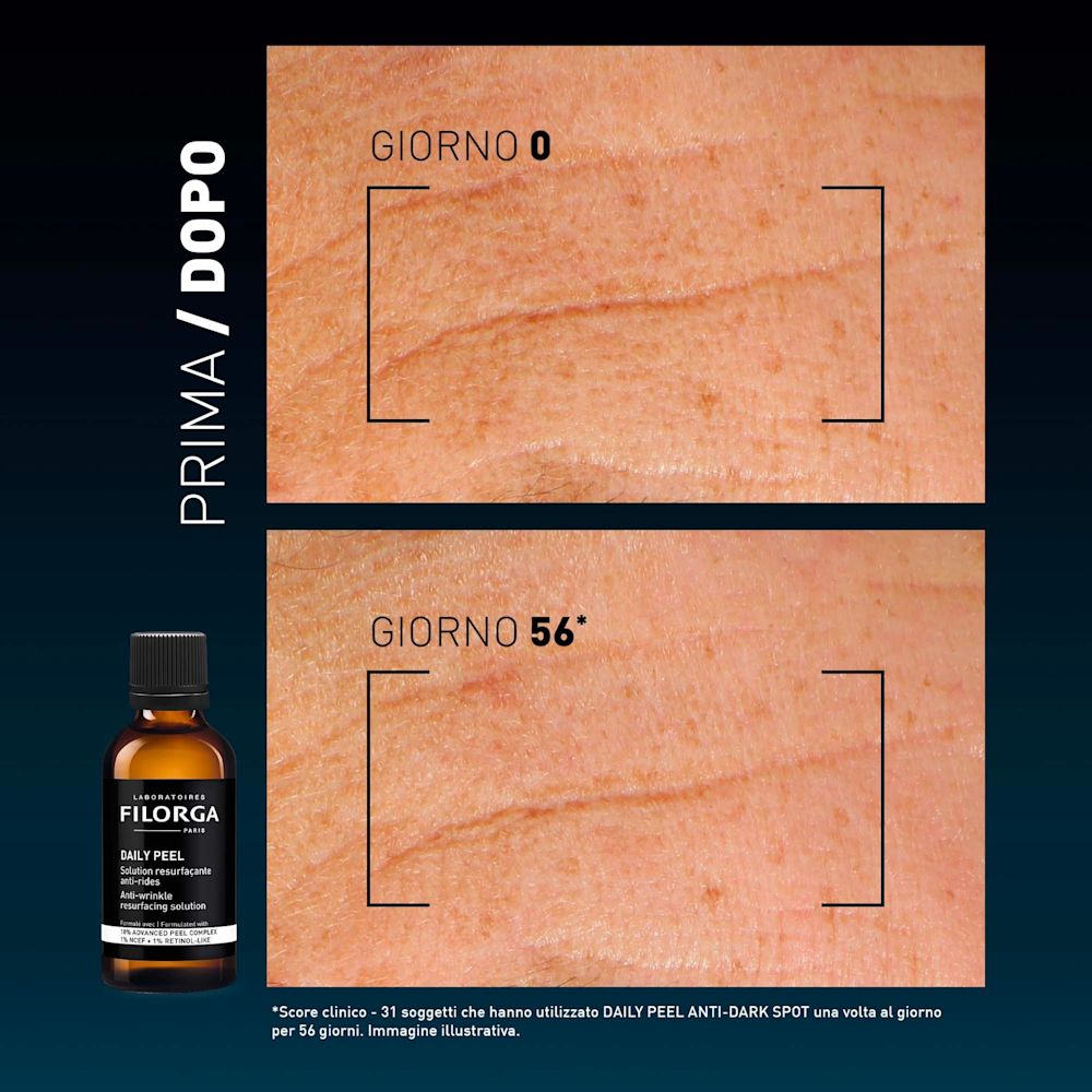 image - 951586130 - Soluzione esfoliante quotidiana ispirata ai peeling professionali, formulata con AHA, attivi retinol-like e complesso NCEF per contrastare rughe e grana irregolare della pelle. - 4859294_18.jpg